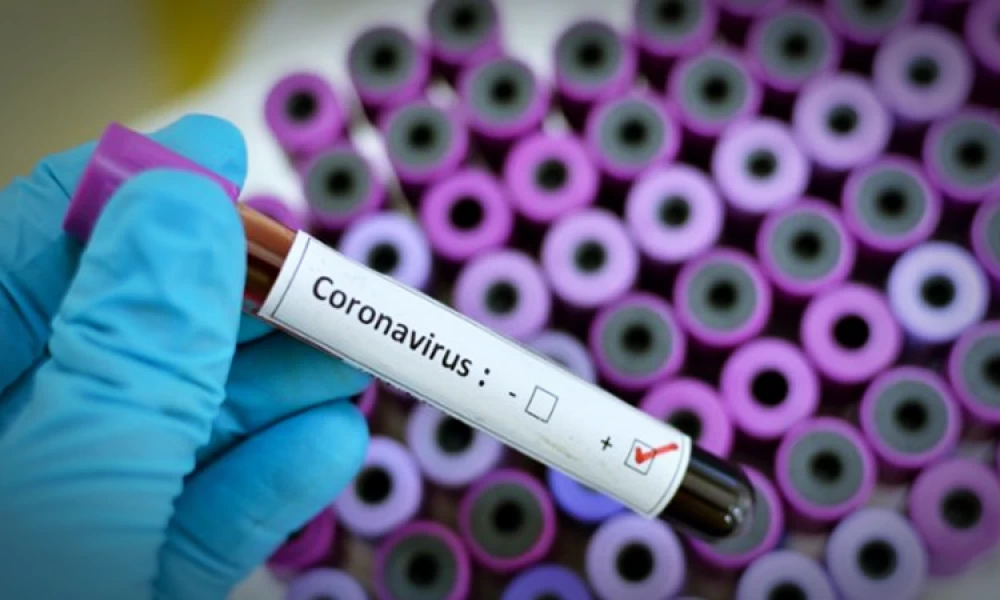 Κύπρος: Αναθεωρημένες οδηγίες προς ταξιδιώτες για τον κορωνοϊό με ισχύ από 14 Μαρτίου 2020